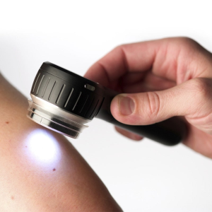 Dermatoscopio DERMLITE DL4 - Imagen 2