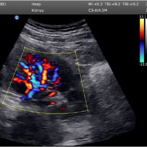 Ecógrafo doppler color Chison Eco 5 - Imagen 3